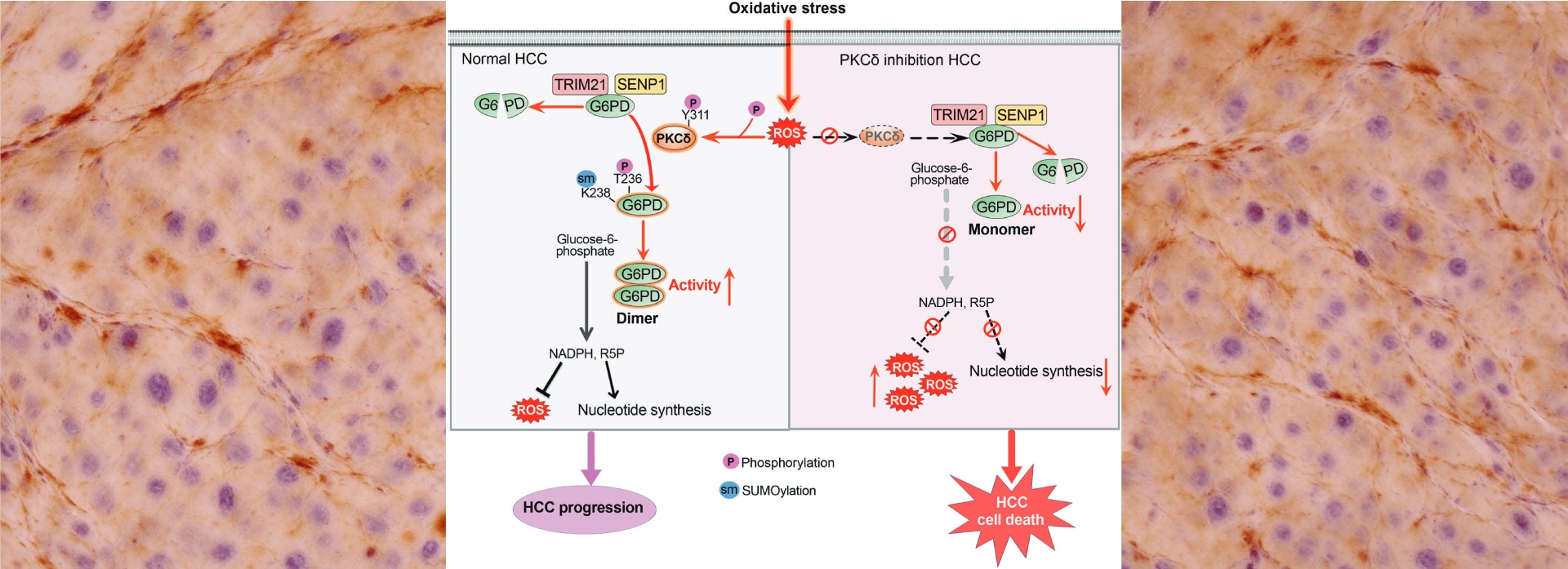 边学利团队在《Cell Death & Differentiation》发表肝癌代谢重编程研究重要成果.jpg